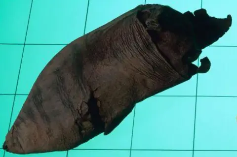 Getty Images A leather shoe, late 14th Century. The large hole in the shoe was caused by wear from a bunion, swelling of the joint associated with displacement of the big toe